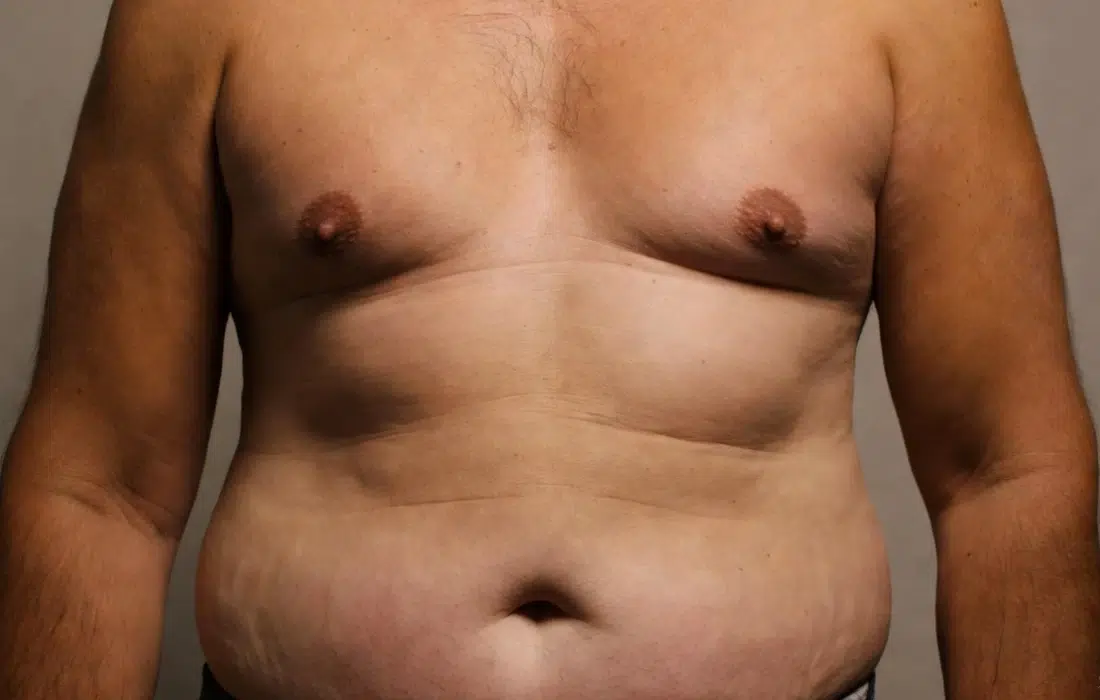 Паласките! Време е да спечелим войната