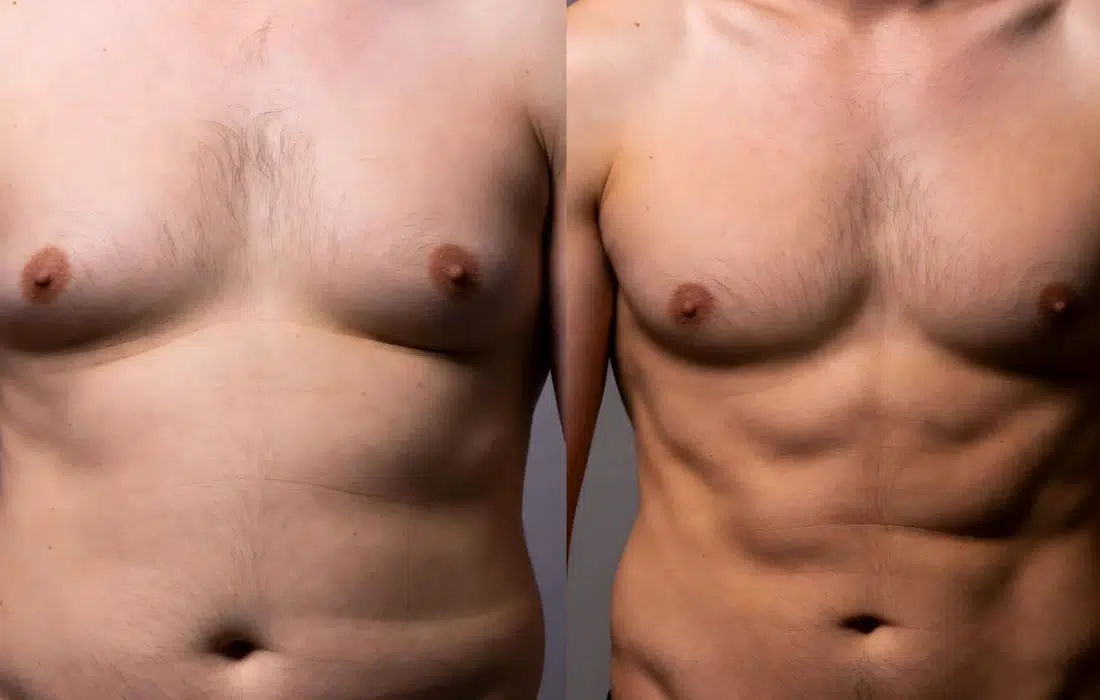 С коремче или да?