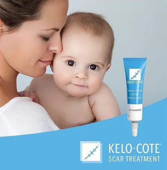 Крем против белези