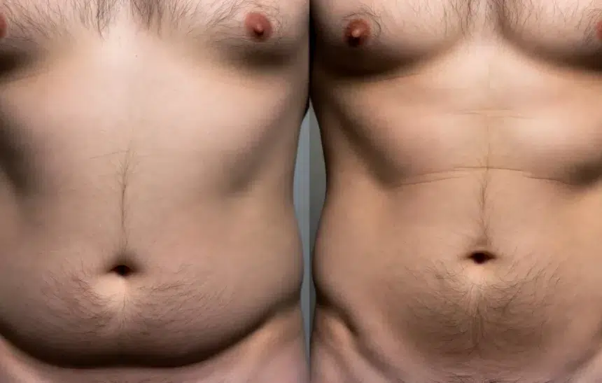 С коремче или да?