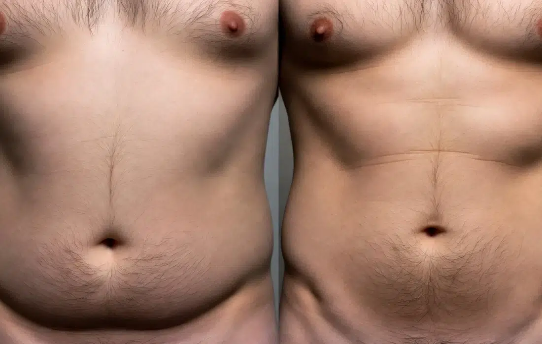 С коремче или да?