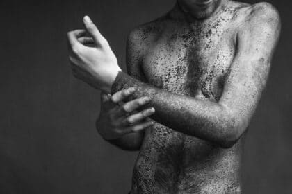 Тялото ви говори чрез кожата, време е да я чуете