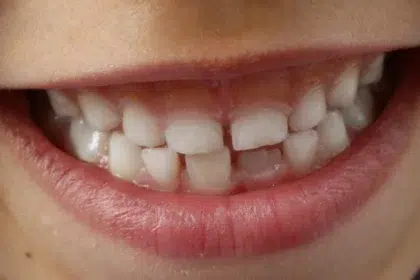 Да се погрижим за детските зъбки!