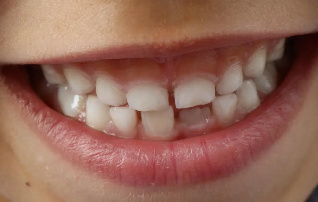 Да се погрижим за детските зъбки!